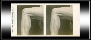 Medical Training and Visualization – Blog Stereoscopy